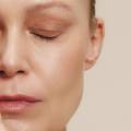 La pelle in premenopausa e in menopausa